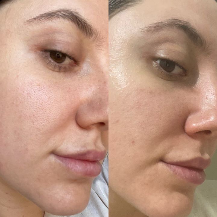 Espuma Facial 150ml