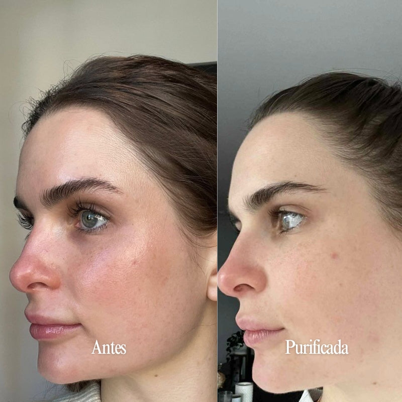 Espuma Facial 150ml