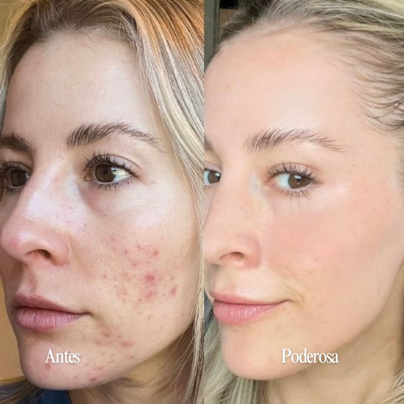 Máscara Revitalizante 100ml